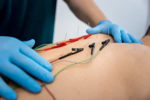 Neuromodulación en Motril en Clínica Prometeo – Tratamiento avanzado para recuperación neuromuscular y alivio del dolor